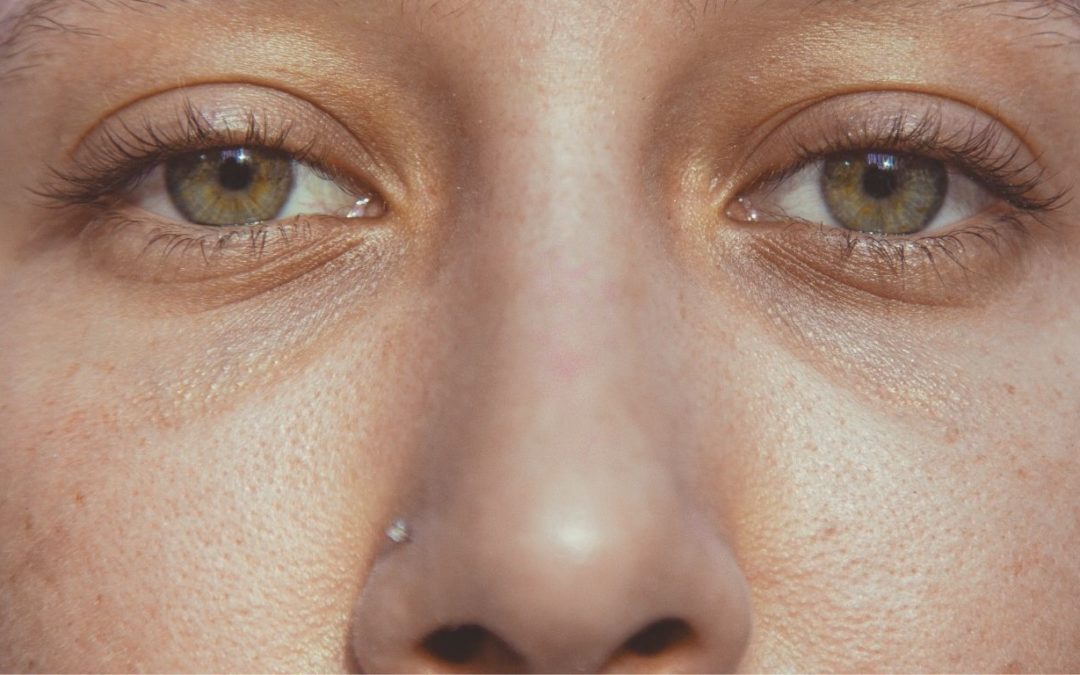Comment réduire les pores dilatés ?